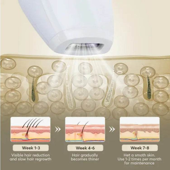 Professional Laser Epilator IPL Hair Removal Body Bikini Leg Depilatory Devic 900,000 Flashes 5 Levels Epilator Painless Electric Epilator Machine - ZEYTONCART