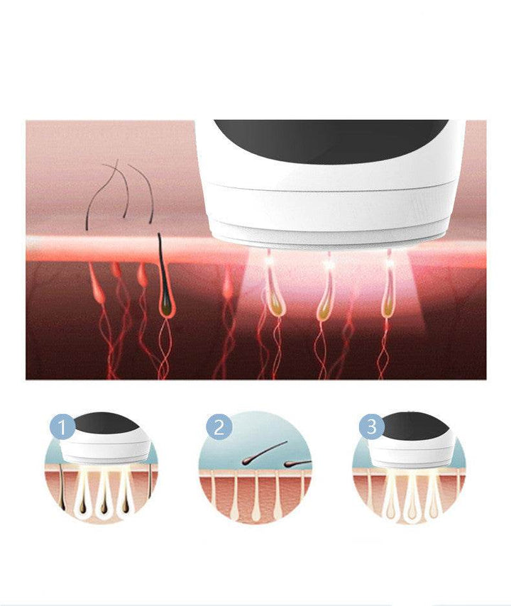 Household body epilator - ZEYTONCART