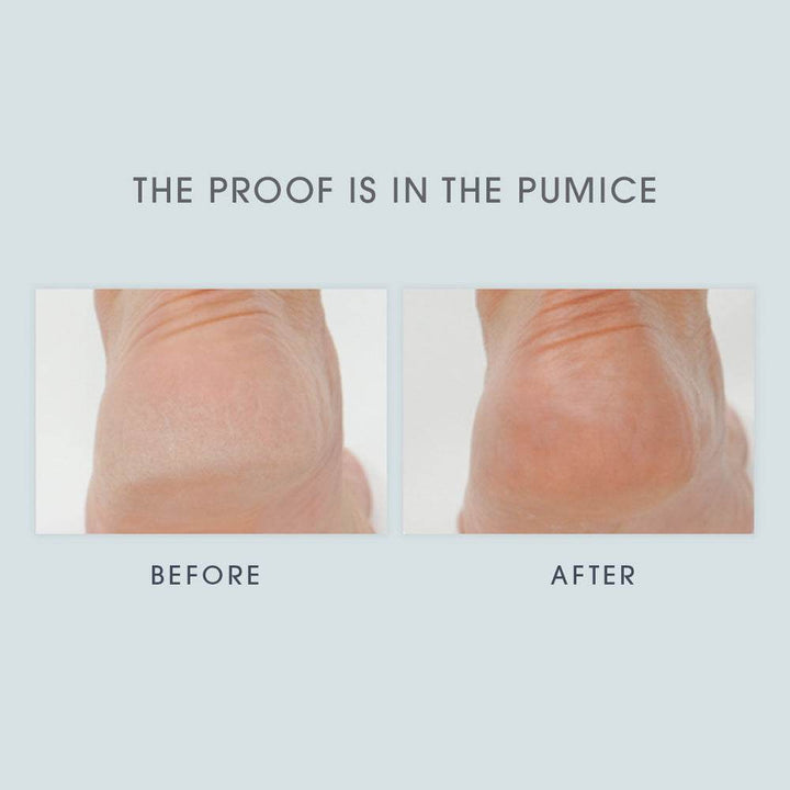 Eucalyptus Foaming Foot Scrub with Pumice 4oz - ZEYTONCART