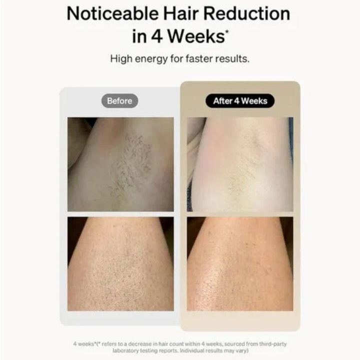 Professional Laser Epilator IPL Hair Removal Body Bikini Leg Depilatory Devic 900,000 Flashes 5 Levels Epilator Painless Electric Epilator Machine - ZEYTONCART